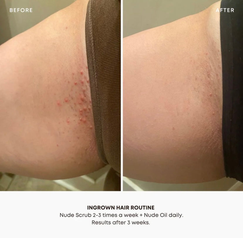 Bushbalm Ingrown Hair Exfoliating Scrub